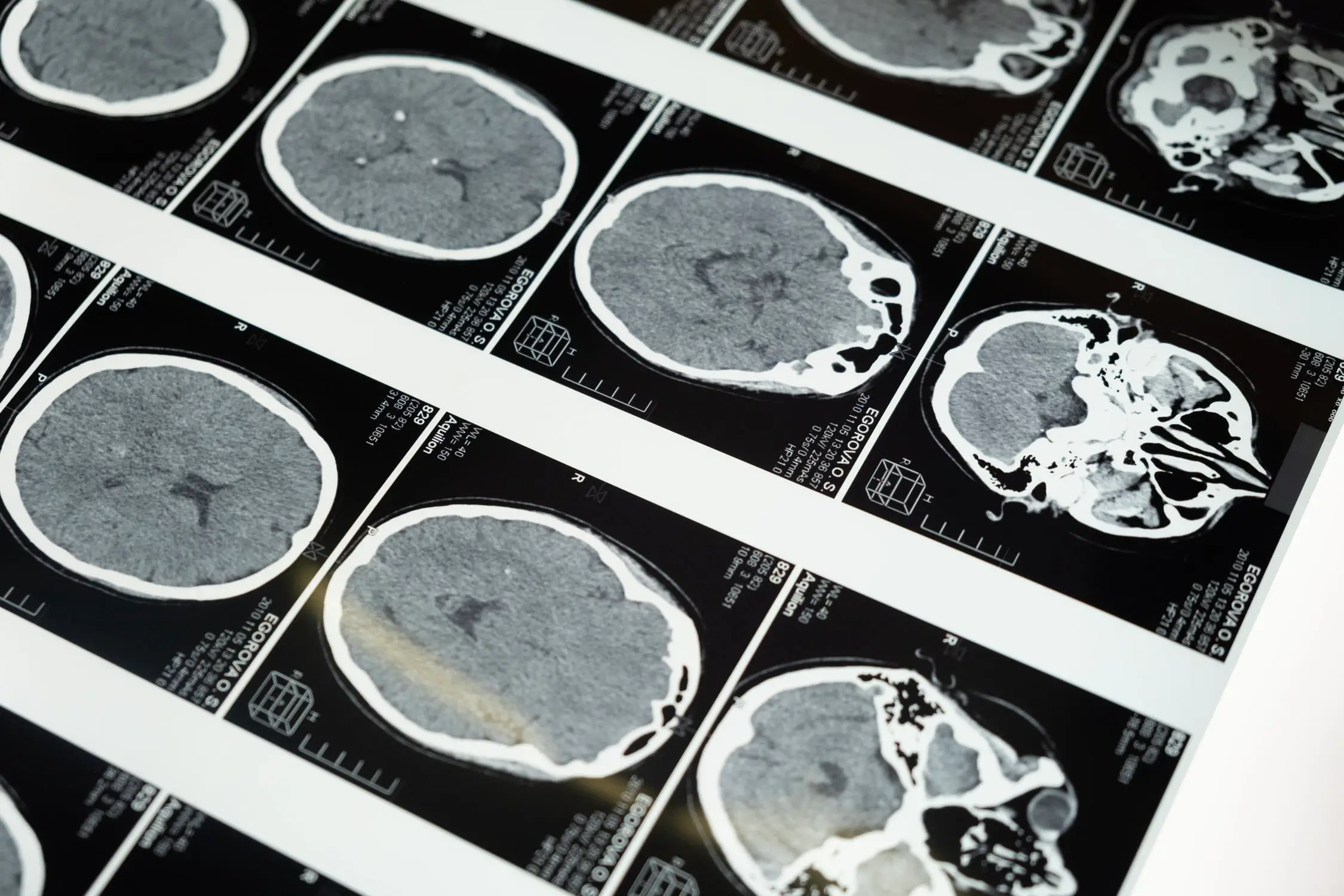 Every step of data collection costs the patient money