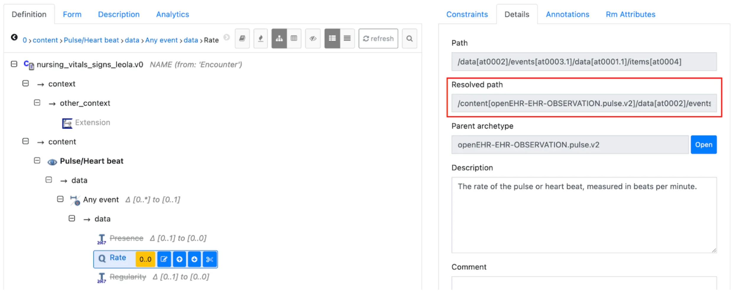 Template editor showing the resolved path for Pulse/Heart beat rate