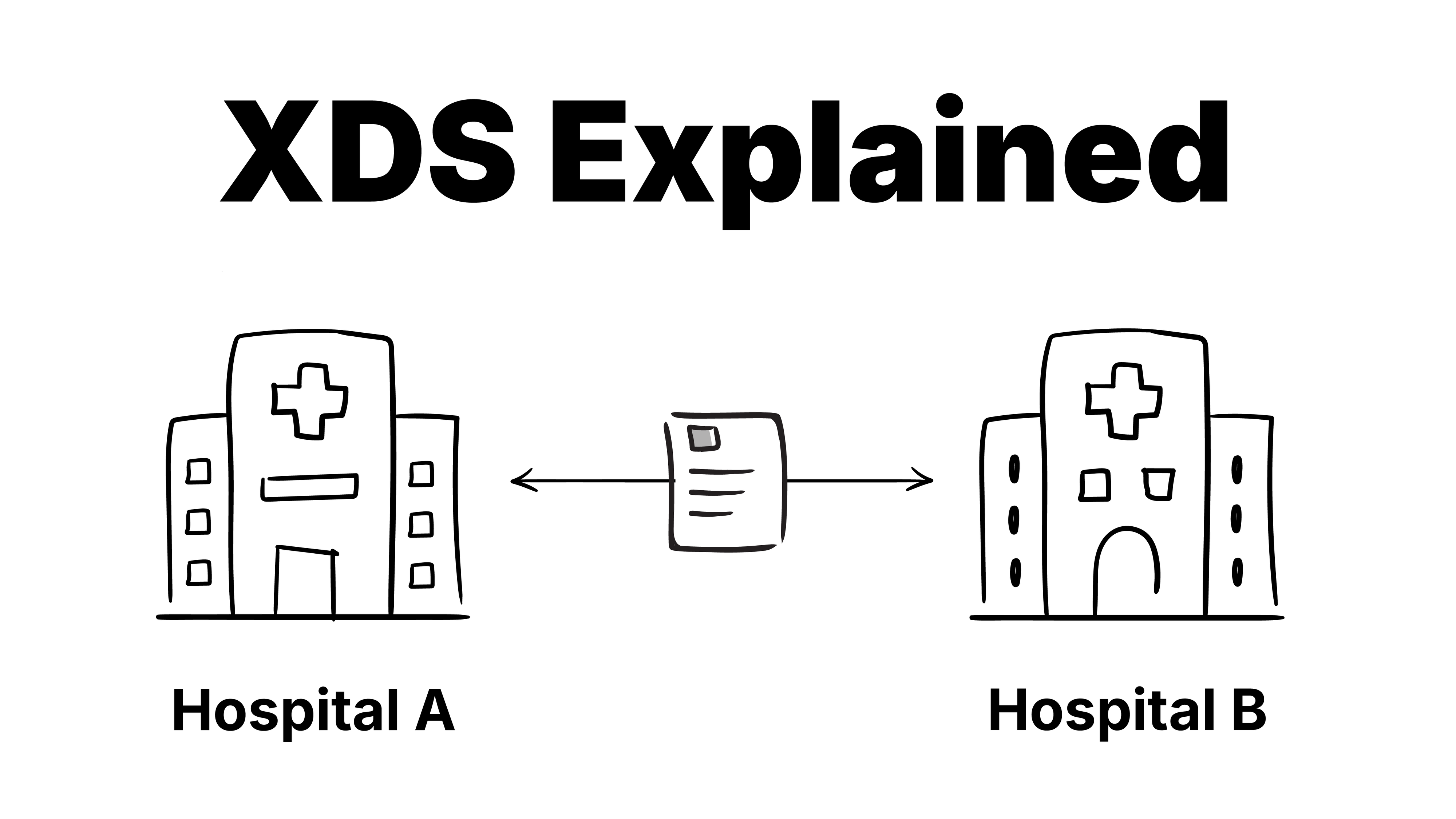 Xds